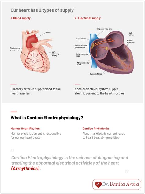 Cardiac Arrhythmias Treatment in Delhi - Dr. Vanita Arora