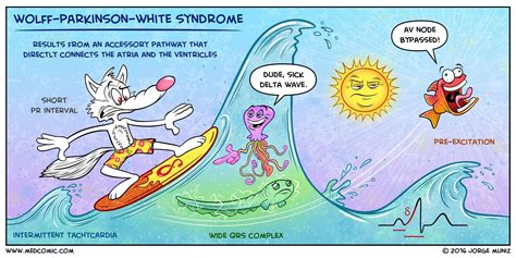 Wolff–Parkinson–White syndrome | Wolff parkinson white syndrome, Nursing study, Medical school ...