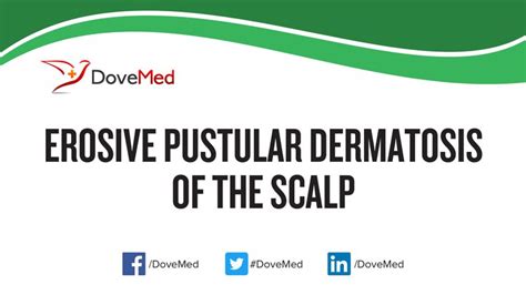 Erosive Pustular Dermatosis of the Scalp