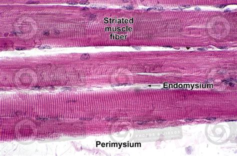 Mammal. Skeletal muscle. Longitudinal section. 500X - Skeletal muscle ...