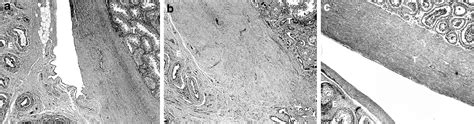 Figure 2 from Anatomy and histology of the scrotal ligament in adults: inconsistency and ...