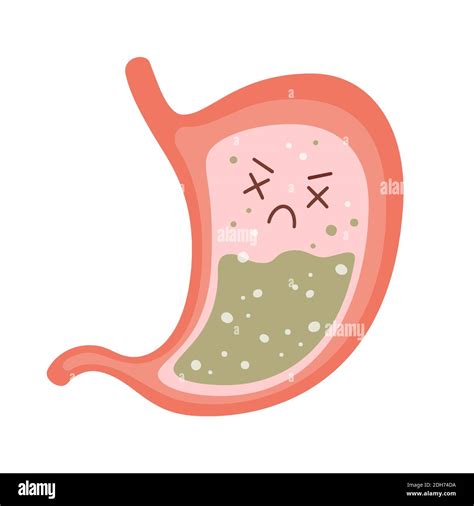 Human stomach. Nausea, vomiting, heartburn, gastritis and acid reflux ...