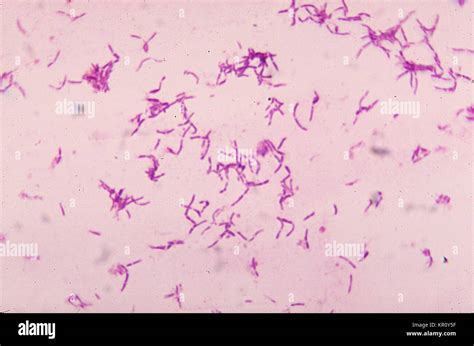 Bifidobacterium Stock Photos & Bifidobacterium Stock Images - Alamy