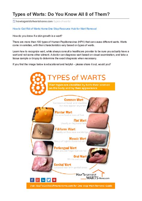 (PDF) Identifying 8 Types of HPV Warts and Their Management