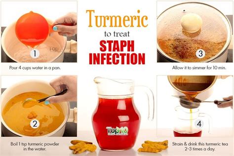 Staph Infection: Prevention and Home Remedies | Top 10 Home Remedies | Staph infection, Staph ...