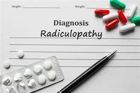 What is Radiculopathy?| Debary Chiropractor | Health In Motion