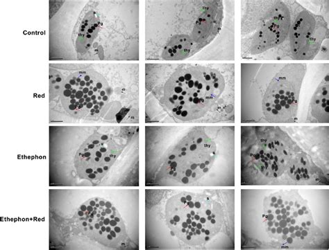 Transmission electron microscopic (TEM) images show the plastid... | Download Scientific Diagram