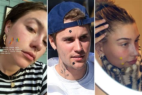 Celebrities love Starface pimple patches