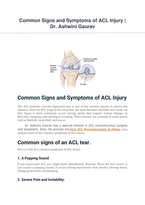 PPT - Common Signs and Symptoms of ACL Injury PowerPoint Presentation, free download - ID:11825324