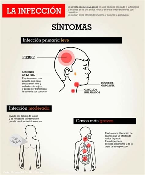 Qué es y cómo se contagia el Streptococcus pyogenes - Mejor Informado