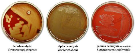 Beta, alpha, and gamma hemolysis | Microbiology, Medical laboratory, Nursing notes