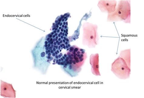 Pin on CYtology