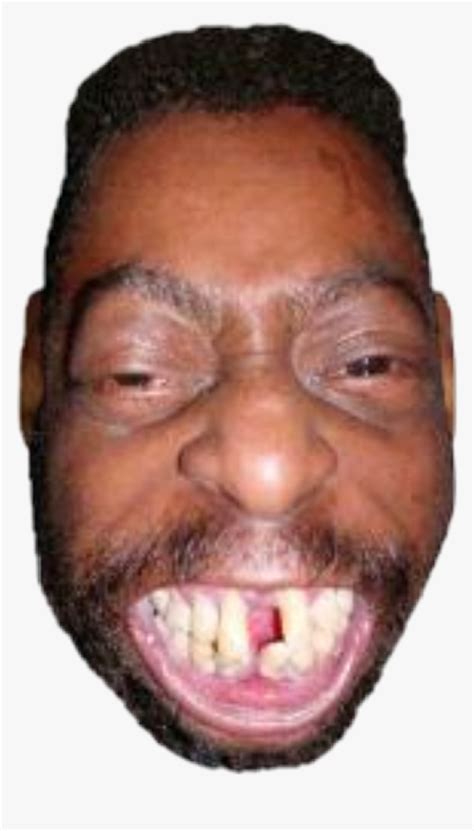 Black People With Messed Up Teeth, HD Png Download - kindpng