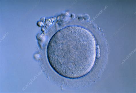 Human egg - Stock Image - P632/0070 - Science Photo Library