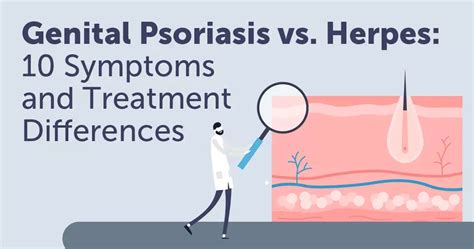 Genital Psoriasis vs. Herpes: 10 Symptom and Treatment Differences | MyPsoriasisTeam