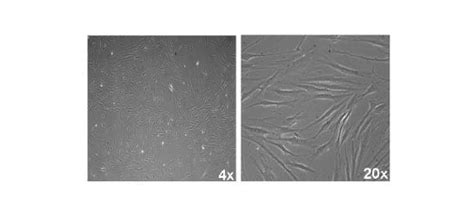 Fibroblast Cell Markers | Research Areas: Novus Biologicals