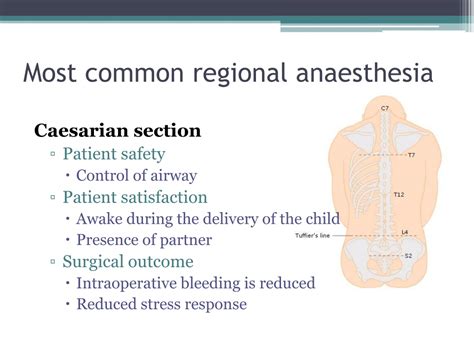 PPT - REGIONAL ANAESTHESIA PowerPoint Presentation, free download - ID ...