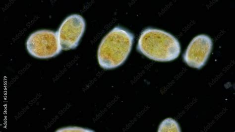 Trochophore larvae under a microscope, possibly at stage of parenchymella from phylum Porifera ...