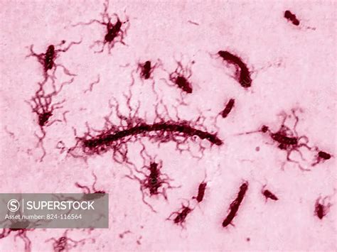 Salmonella Typhi Under A Microscope