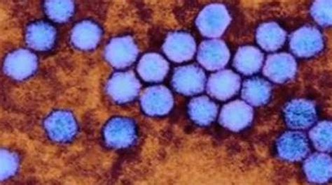 Enterovirus link probed in deaths of girl, 3 others