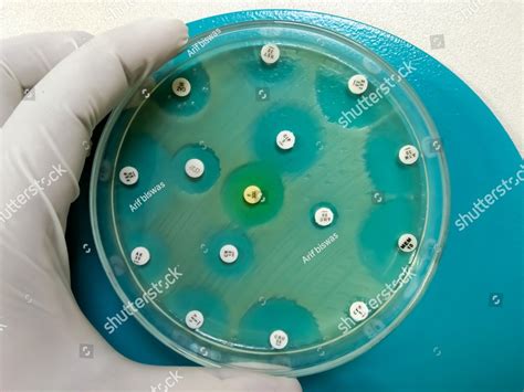 Petri dish showing all Antibiotic is resistance of the sample. Antibiotic activity testing ...