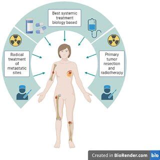 Aggressive approach combining modern systemic therapy, locoregional ...