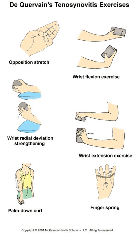 Sports Medicine Advisor 2003.1: De Quervain's Tenosynovitis Exercises ...