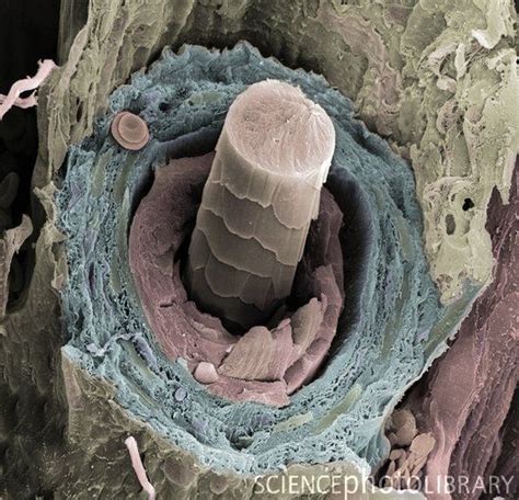 Hair follicle, coloured SEM | Hair follicle, Hair science, Microscopic photography