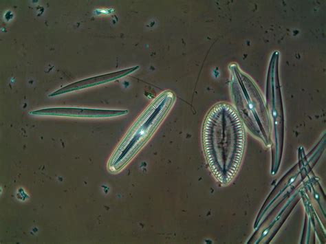 Diatoms! - Cloudy Days & Microscopes - Cloudy Nights