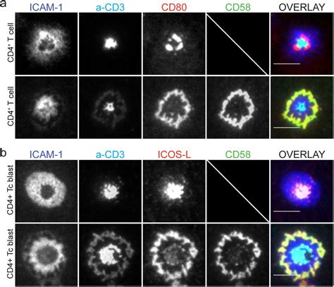 CD2 expression acts as a quantitative checkpoint for immunological synapse structure and T-cell ...