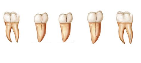 What Is a Dental Root Fracture and How Do You Treat It? - Your Dental Health Resource