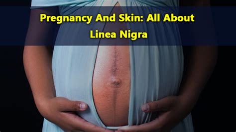 Pregnancy And Skin: What To Know About Linea Nigra And Its Causes ...