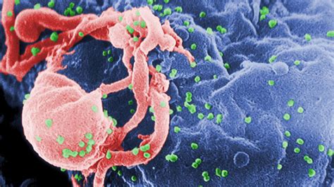 HIV's ability to cause AIDS is weakening over time, study finds | Fox News