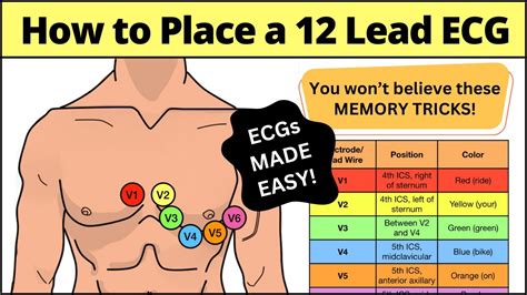 12 Lead ECG Placement MADE EASY [EMT, Nursing, Paramedic] #ecg #nursing - YouTube