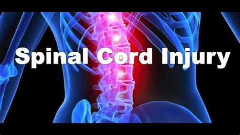 Spinal Cord Injury - Symptoms And Causes