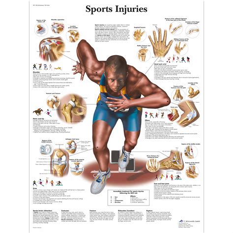 Sports Injuries Chart - 1001494 - VR1188L - Muscle - 3B Scientific