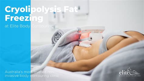 Cryolipolysis Fat Freezing - YouTube