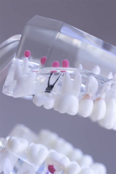 Dental teeth mouth model stock image. Image of stomatology - 101058037