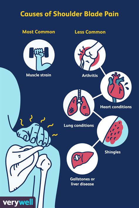 Shoulder Blade Pain Symptoms Causes Types Treatment Exercise - Otosection