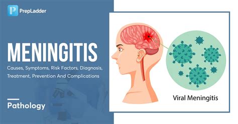 Meningitis: Causes, Symptoms, Risk Factors, Diagnosis, Treatment ...