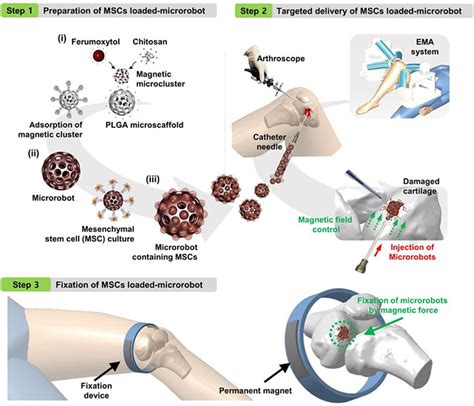 Magnetic Microrobots Deliver Stem Cells to Regenerate Knee Cartilage