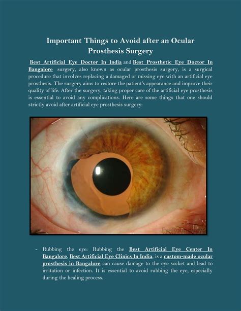 Important Things to Avoid after an Ocular Prosthesis Surgery by ...