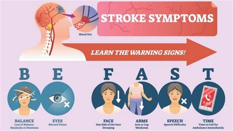 Stroke: Types, Symptoms, and Long-Term Outlook | 1MD Nutrition™