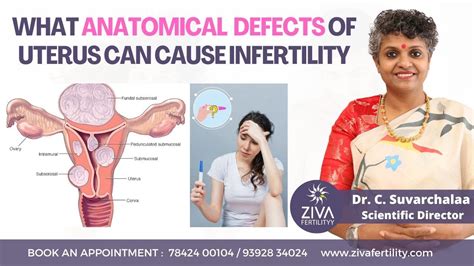 Uterine Abnormalities || Anatomic Uterine Defects || Infertility || Dr ...