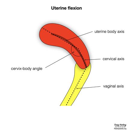 Images | Radiopaedia.org