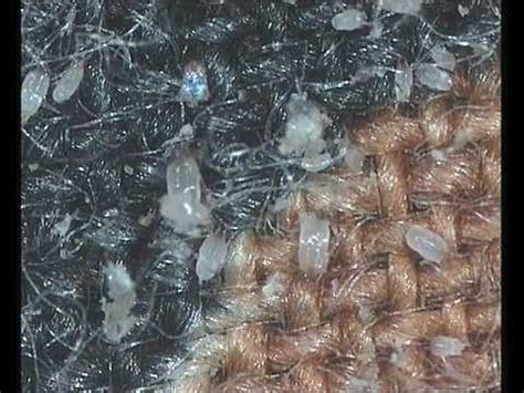 house dust mites - YouTube