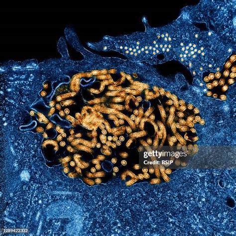 317 Ebola Virus Microscope Stock Photos, High-Res Pictures, and Images - Getty Images