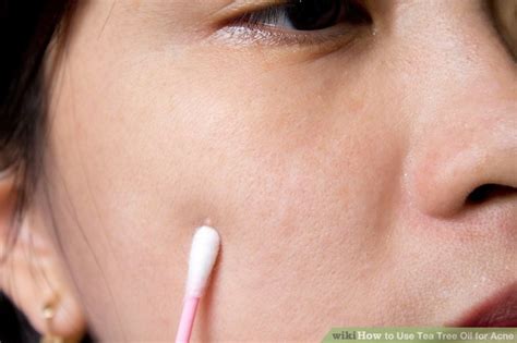 How to Use Tea Tree Oil for Acne: 12 Steps (with Pictures)