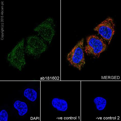 Recombinant Anti-GAPDH antibody [EPR16891] - Loading Control (ab181602) | Abcam