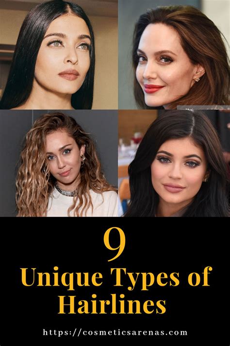 9 Types of Hairlines You Never Knew Existed! - Cosmetics Arena